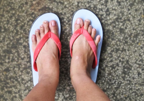 Does wearing sandals help with toenail fungus?