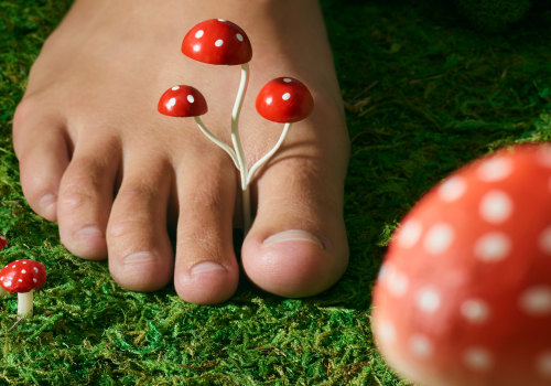 What Should I Do If My Toenail Fungus Treatment Isn't Working?